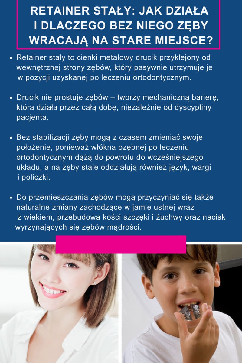Retainer stały: jak działa i dlaczego bez niego zęby wracają na stare miejsce